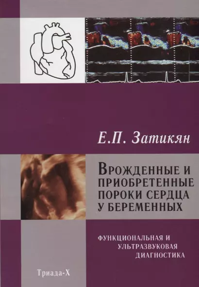 Врожденные и приобретенные пороки сердца у беременных Функциональная и ультразвуковая диагностика (З - фото 1