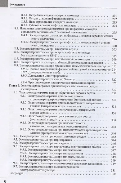 Электрокардиография - фото 5