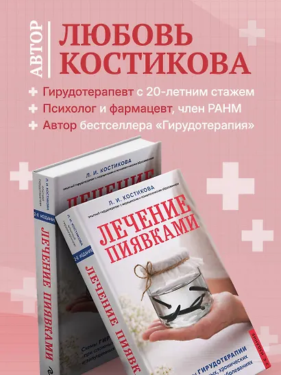 Лечение пиявками. Схемы гирудотерапии при сложных, хронических и запущенных заболеваниях - фото 5