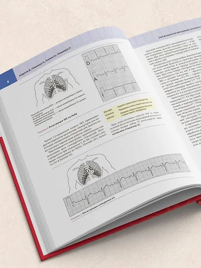 Атлас электрокардиографии. Интерпретация результатов: от простого к сложному - фото 8