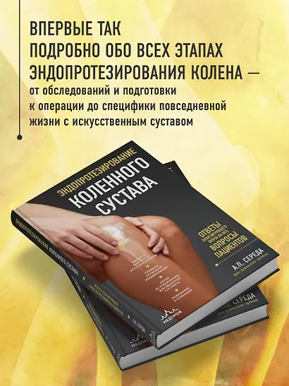 Эндопротезирование коленного сустава: ответы практикующего врача на все вопросы пациентов - фото 5