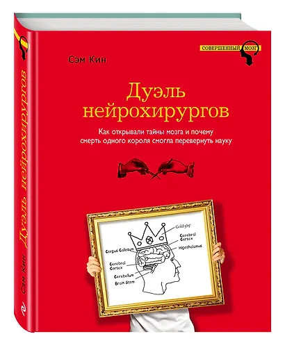 Дуэль нейрохирургов. Как открывали тайны мозга и почему смерть одного короля смогла перевернуть науку - фото 3
