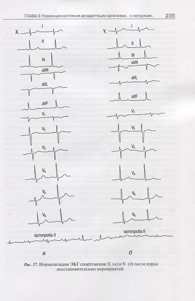 Мужчина и женщина в спорте высших достижений (проблемы полового диморфизма) - фото 7