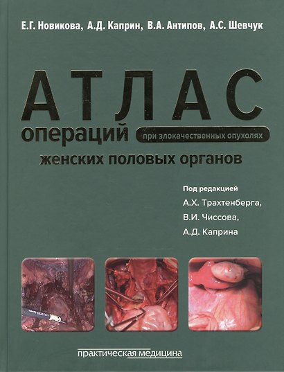 Атлас операций при злокачественных опухолях женских половых органов (Новикова) - фото 1