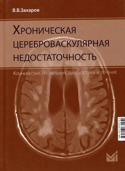 Хроническая цереброваскулярная недостаточность - фото 1