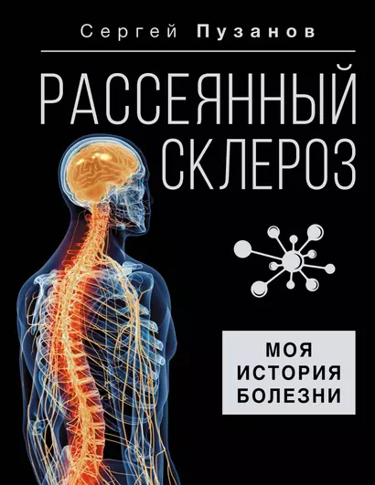 Рассеянный склероз. Моя история болезни - фото 1