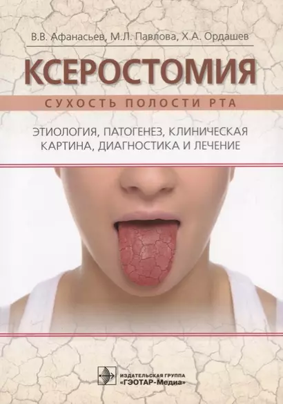 Ксеростомия. Сухость полости рта. Этиология, патогенез, клиническая картина, диагностика и лечение - фото 1