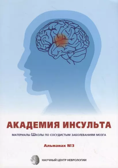 Академия Инсульта. Материалы Школы Научного центра неврологии по сосудистым заболевания мозга - фото 1