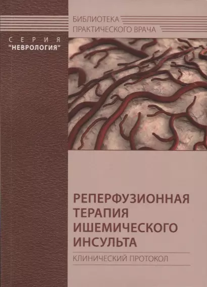 Реперфузионная терапия ишемического инсульта. Клинический протокол - фото 1