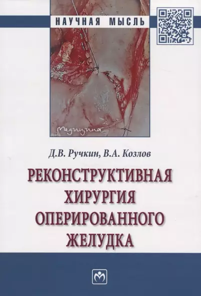 Реконструктивная хирургия оперированного желудка. Монография - фото 1