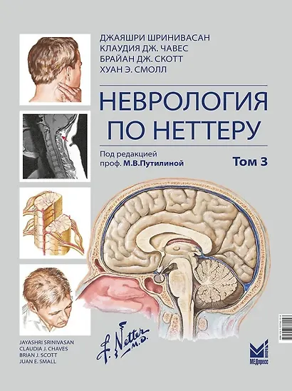 Неврология по Неттеру: В 3-х томах. Том 3 - фото 1