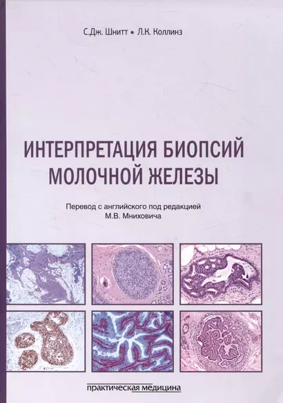 Интерпретация биопсий молочной железы - фото 1