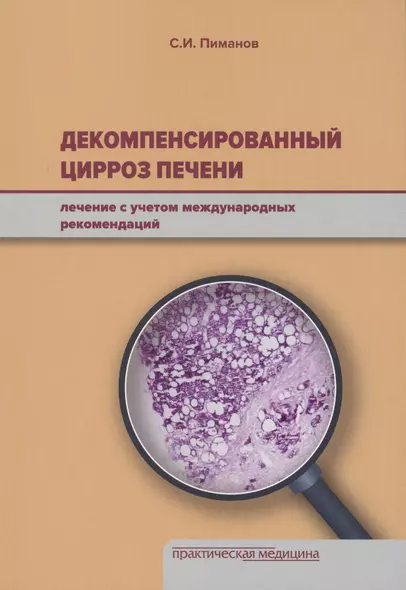 Декомпенсированный цирроз печени: лечение с учетом международных рекомендаций. - фото 1