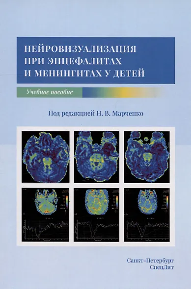 Нейровизуализация при энцефалитах и менингитах у детей. Учебное пособие - фото 1