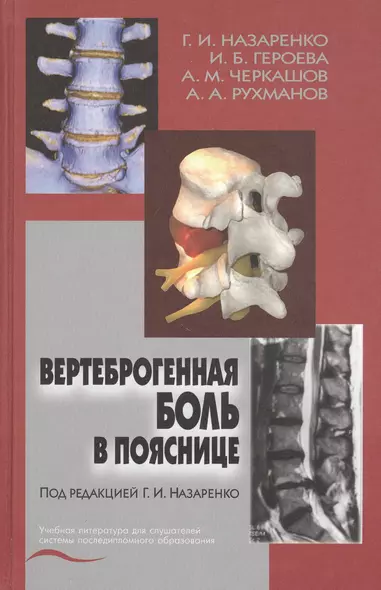 Вертеброгенная боль в пояснице (технология диагностики и лечения). Учебное пособие - фото 1