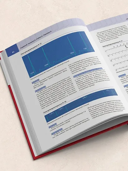 Атлас электрокардиографии. Интерпретация результатов: от простого к сложному - фото 10