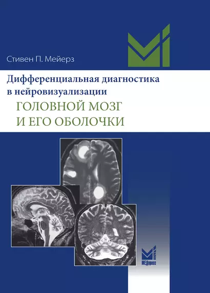 Дифференциальная диагностика в нейровизуализации. Головной мозг и его оболочки - фото 1