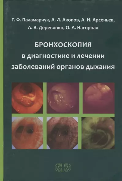 Бронхоскопия в диагностике и лечении заболеваний органов дыхания - фото 1