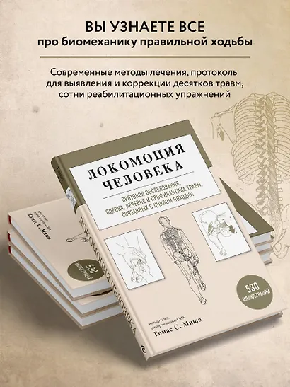 Локомоция человека. Протокол обследования, оценка, лечение и профилактика травм, связанных с циклом походки - фото 6