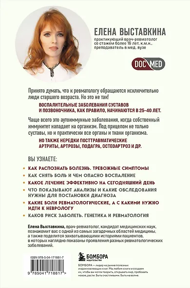 Ревматология по косточкам. Симптомы, диагнозы, лечение - фото 2