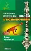 Отложение солей в позвоночнике: Правда и вымысел - фото 1