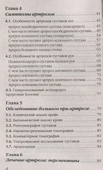 Артроз Избавляемся от болей в суставах Причины Симптомы… (3 изд.) (мМетодДокЕвд) Ефдокименко - фото 3