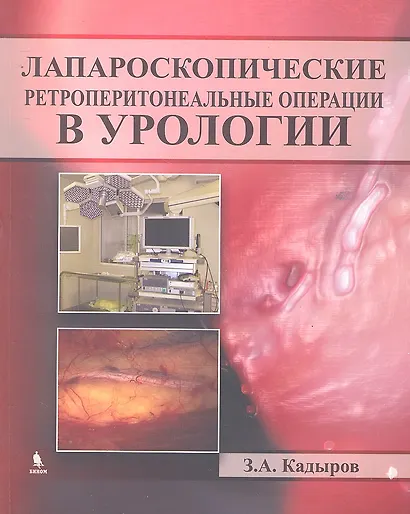 Лапароскопические ретроперитонеальные операции в урологии - фото 1