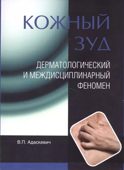 Кожный зуд. Дерматологический и междисциплинарный феномен. - фото 1