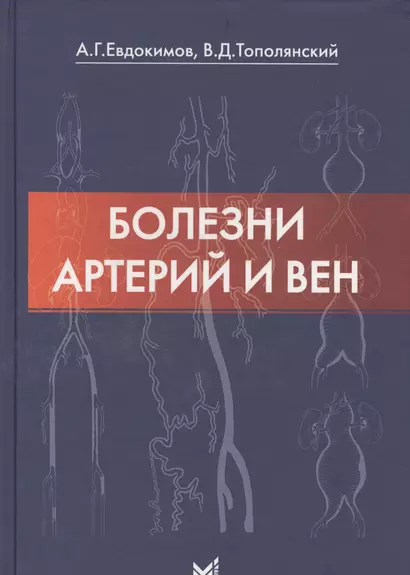 Болезни артерий и вен / 2-е изд. - фото 1