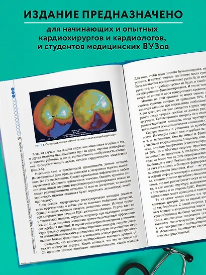 Клинические аспекты сердечно-сосудистой хирургии - фото 7