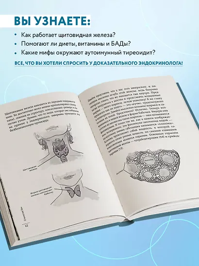 Страсти по щитовидке. Аутоиммунный тиреоидит, гипотиреоз: почему иммунитет работает против нас? - фото 5