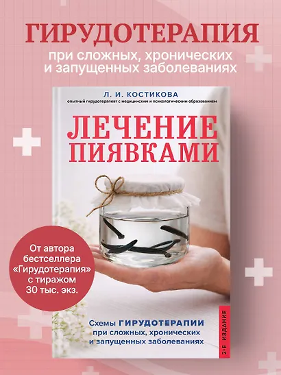 Лечение пиявками. Схемы гирудотерапии при сложных, хронических и запущенных заболеваниях - фото 4