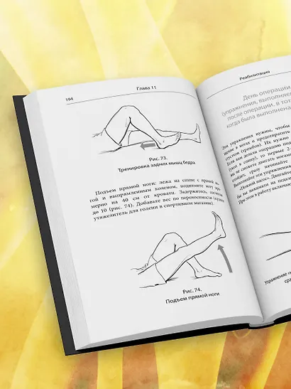 Эндопротезирование коленного сустава: ответы практикующего врача на все вопросы пациентов - фото 9