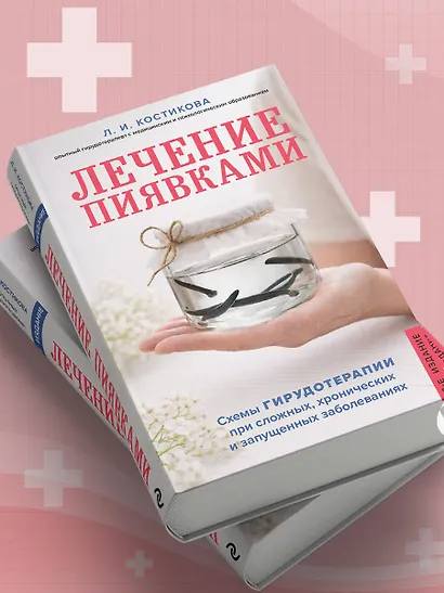 Лечение пиявками. Схемы гирудотерапии при сложных, хронических и запущенных заболеваниях - фото 8