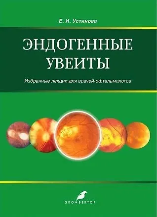 Эндогенные увеиты - фото 1