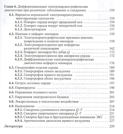 Электрокардиографическая дифференциальная диагностика - фото 4