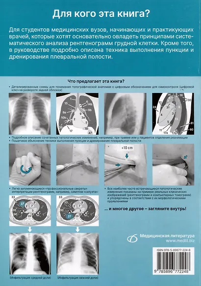 Рентгенологическое исследование грудной клетки. Практическое руководство. Атлас - фото 2