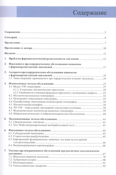 Хирургическое лечение эпилепсии у детей: показания, вопросы предхирургического обследования - фото 2