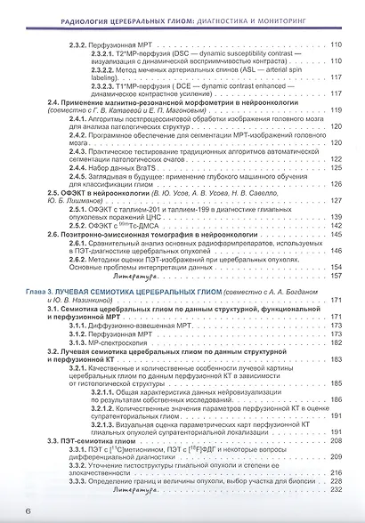 Радиология церебральных глиом диагностика и мониторинг - фото 3