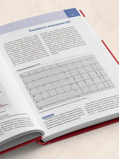 Атлас электрокардиографии. Интерпретация результатов: от простого к сложному - фото 9