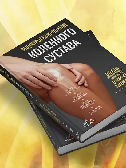 Эндопротезирование коленного сустава: ответы практикующего врача на все вопросы пациентов - фото 8