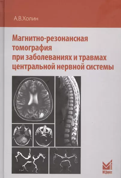 Магнитно-резонансная томография при заболеваниях и травмах центральной нервной системы - фото 1