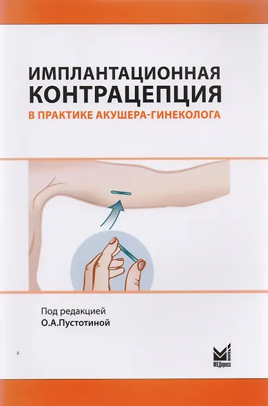 Имплантационная контрацепция в практике акушера-гинеколога - фото 1