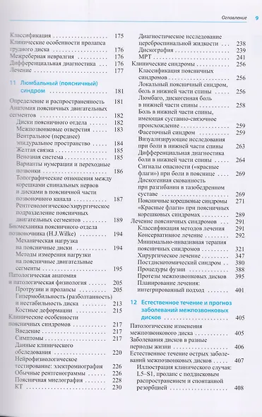 Заболевания межпозвонковых дисков - фото 4