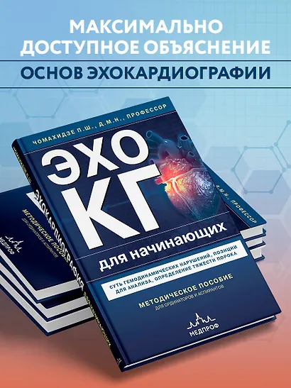 Эхокардиография для начинающих. Суть гемодинамических нарушений, позиции для анализа, определение тяжести порока - фото 5