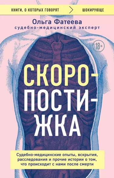 Скоропостижка. Судебно-медицинские опыты, вскрытия, расследования и прочие истории о том, что происходит с нами после смерти - фото 1