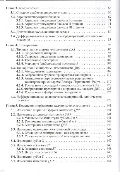 Электрокардиографическая дифференциальная диагностика - фото 3