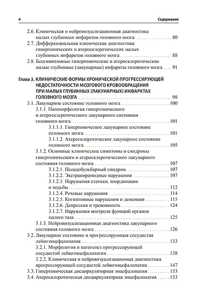 Малые инфаркты головного мозга - фото 3