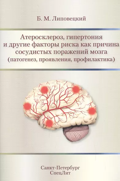 Атеросклероз,гипертония и другие факторы риска как причина с - фото 1