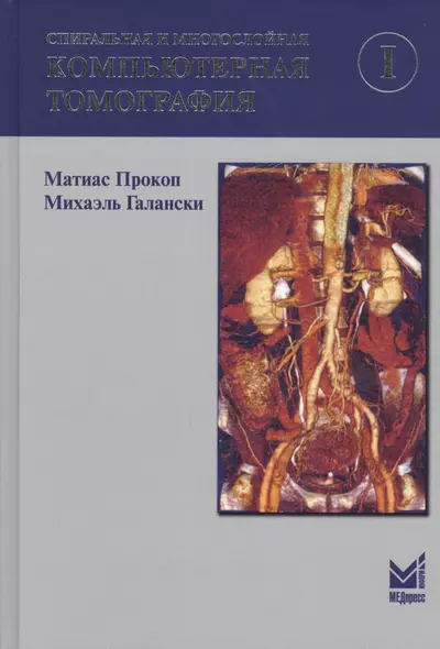 Спиральная и многослойная компьютерная томография. Том 1. Учебное пособие - фото 1